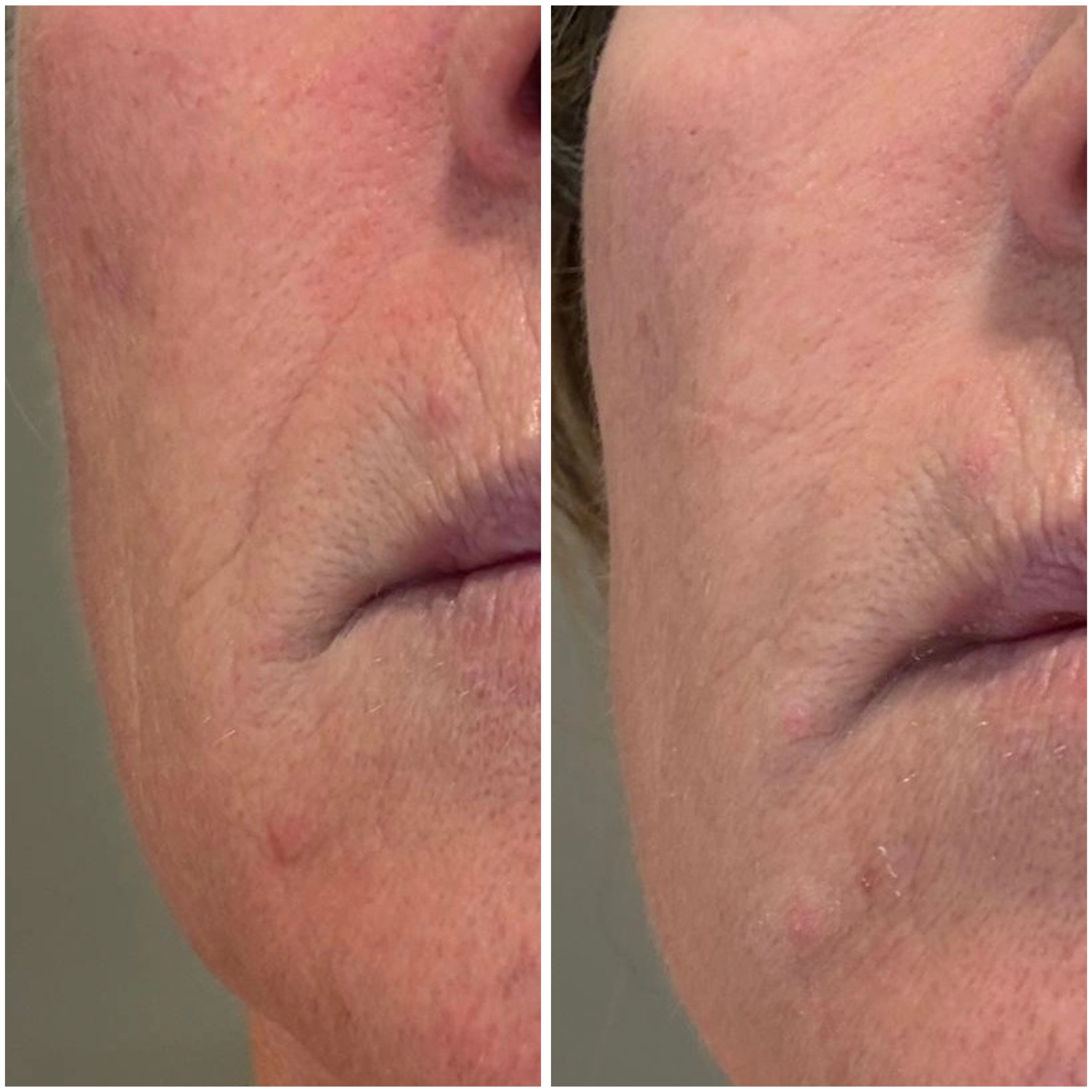 5 Reasons Thousands of Women Are Adding Face & Tape to Their Nighttime Routine