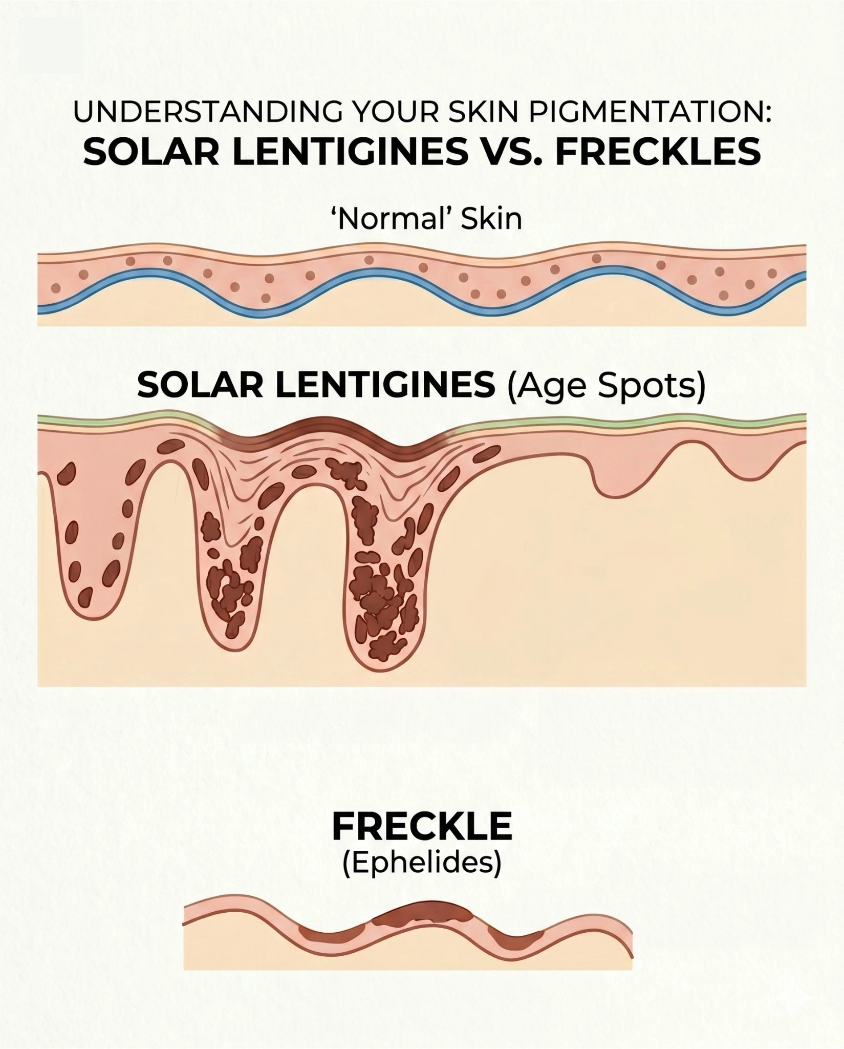 Now that you know what they are - here's why they keep getting worse