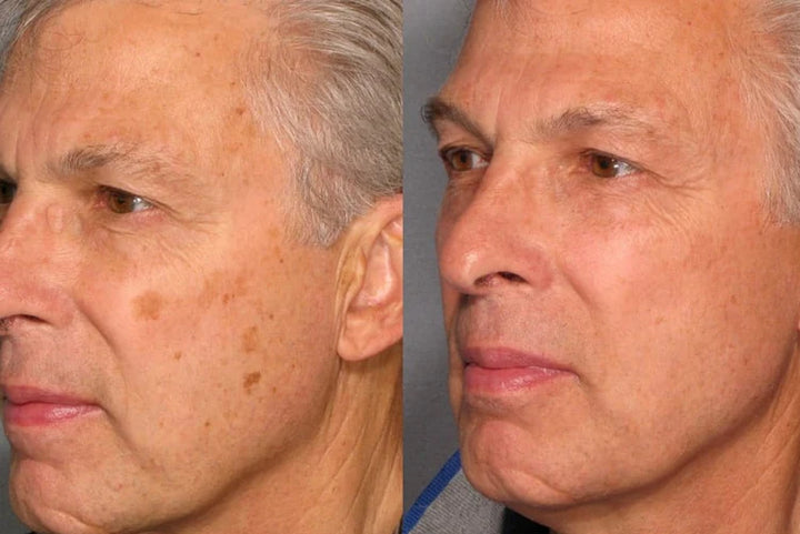 Your Path To Clearer Skin