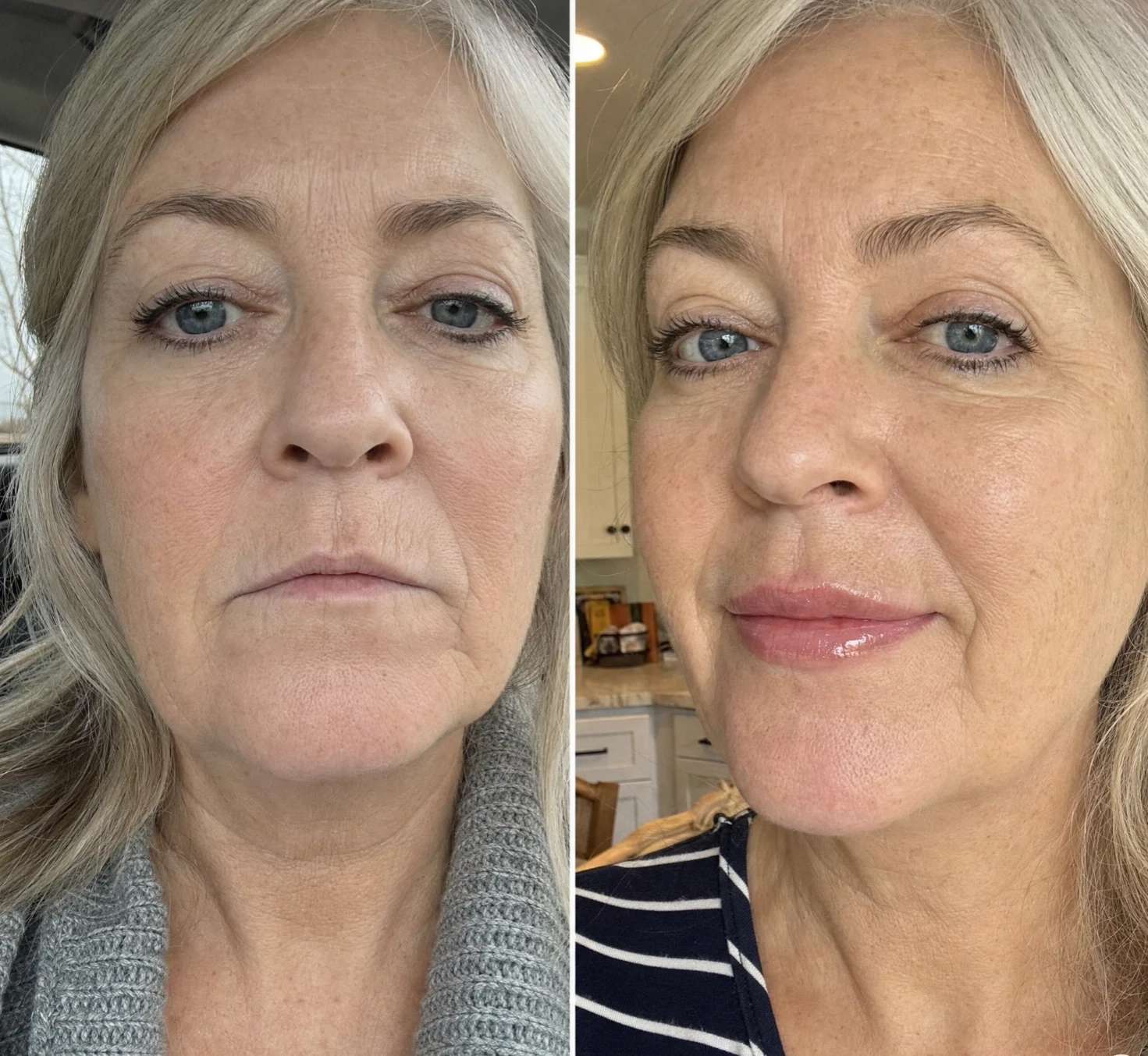 Real, Visible Lip Care Results