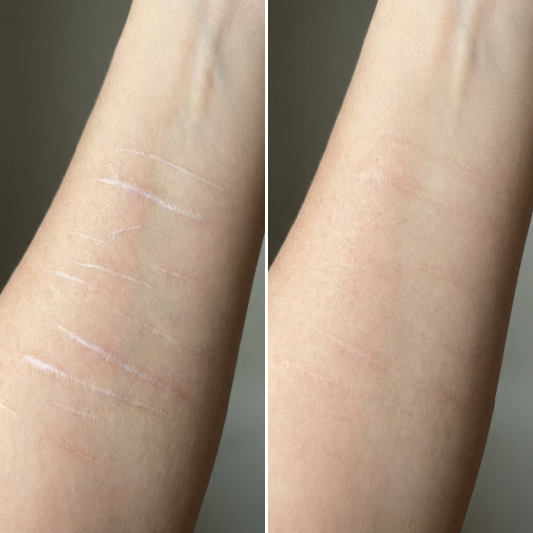 Finally Address The Marks Of Your Past In Total Privacy