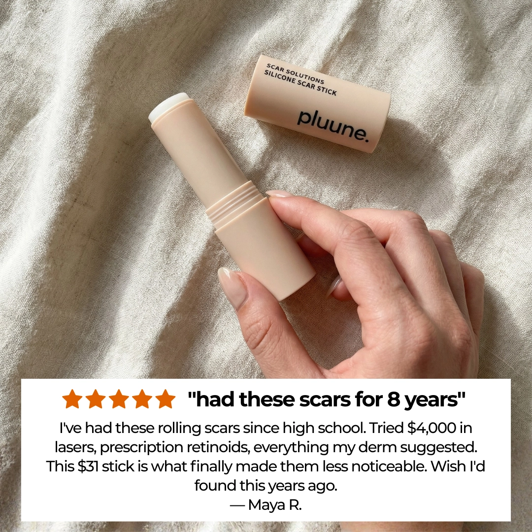 5 Reasons Why This Surgeon’s Secret Is Fading 10-Year-Old Acne Scars