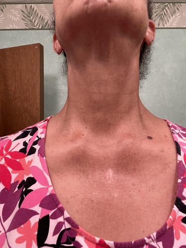 Clinically Proven Skin Restoration