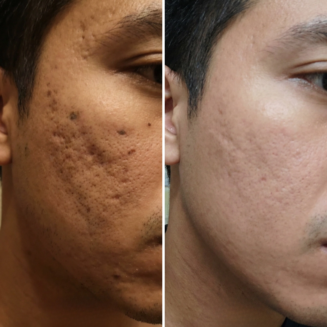 Testimonial
