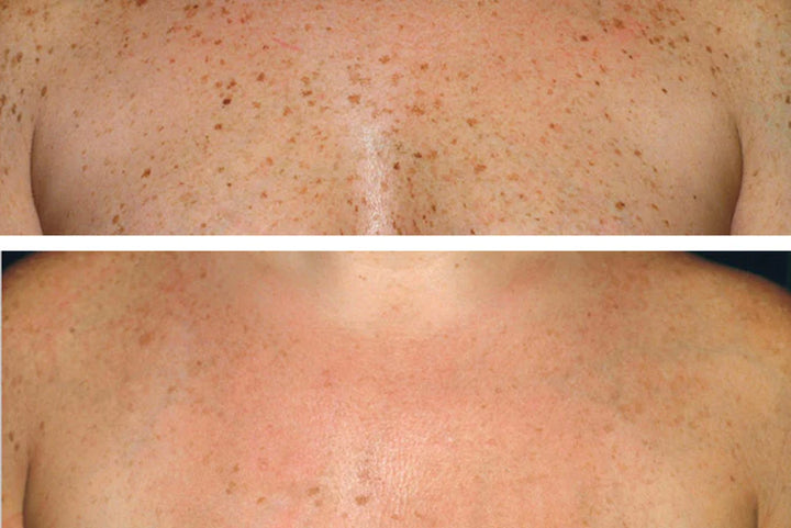 Clinically-Inspired Results
