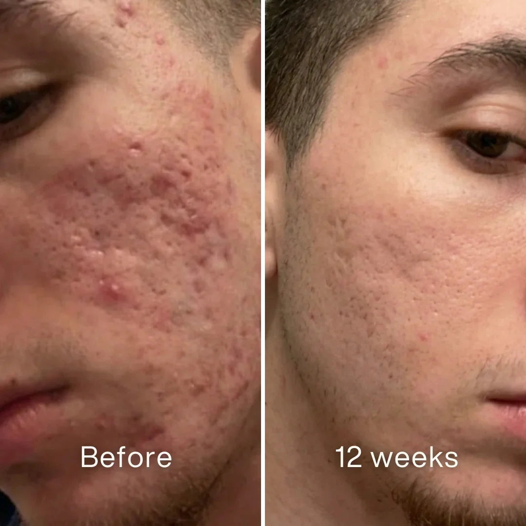 The Path to Smoother Skin