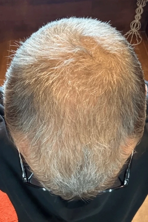 DAY 60 · Stronger Looking Hair