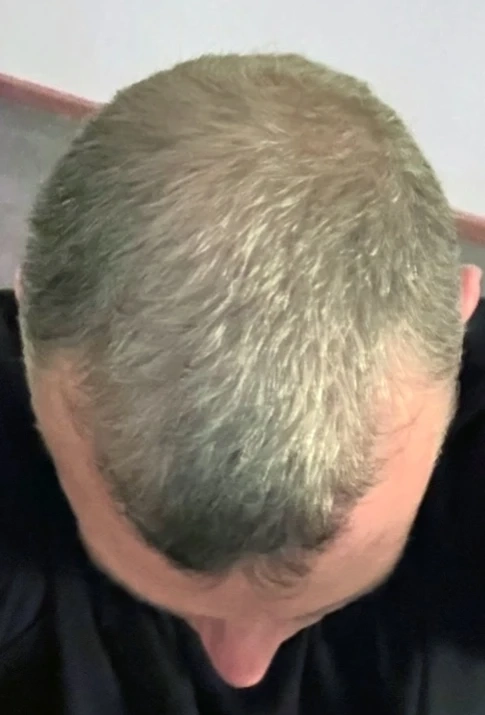 DAY 90 · Thicker Looking Hair
