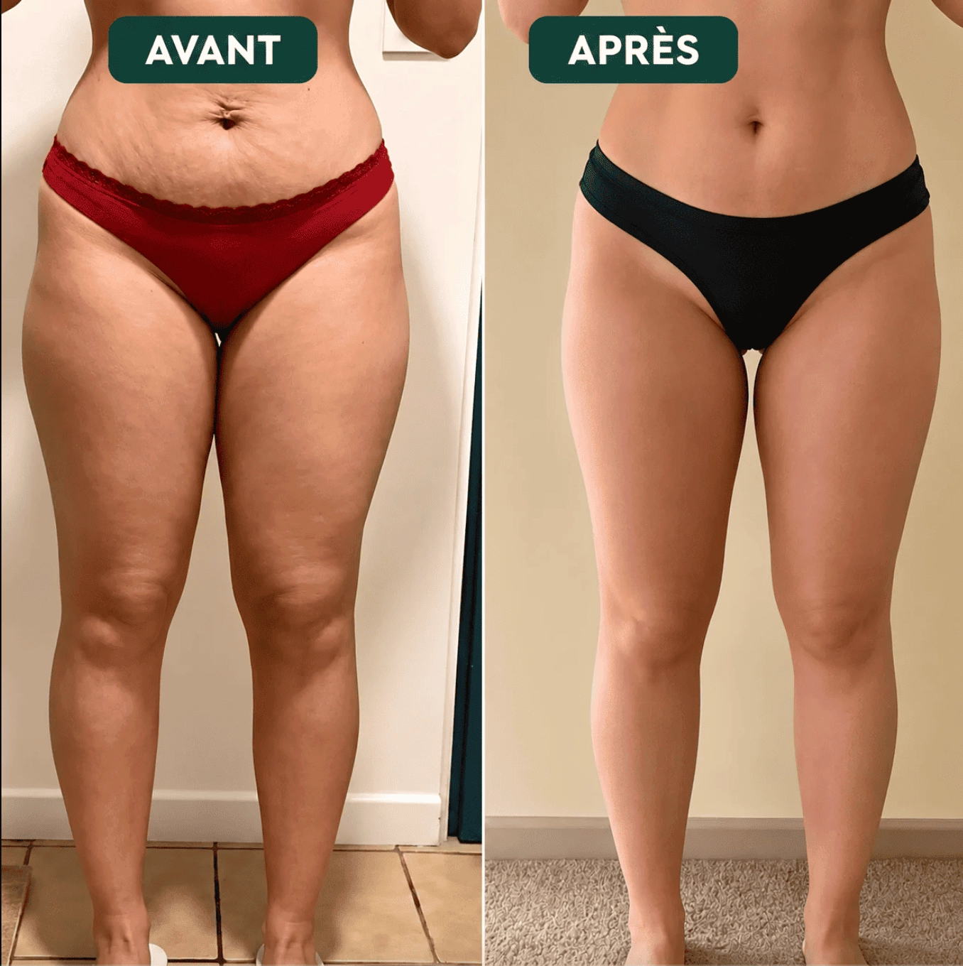 À quoi s'attendre pendant votre cure?