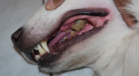 Routine dental checkups can catch gum issues early