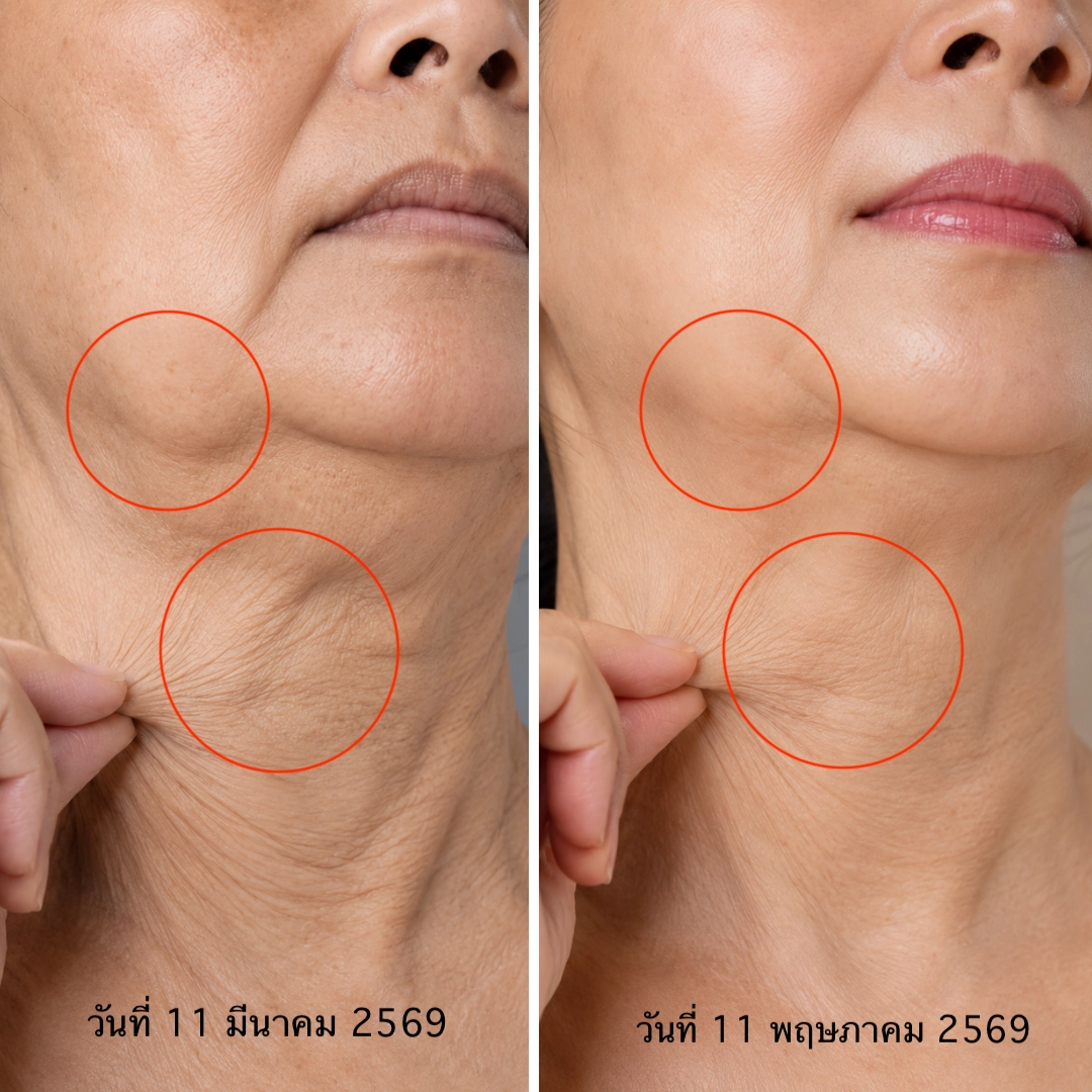 ฟื้นคืนผิวให้ดูสดใสอีกครั้ง… ทีละสัปดาห์