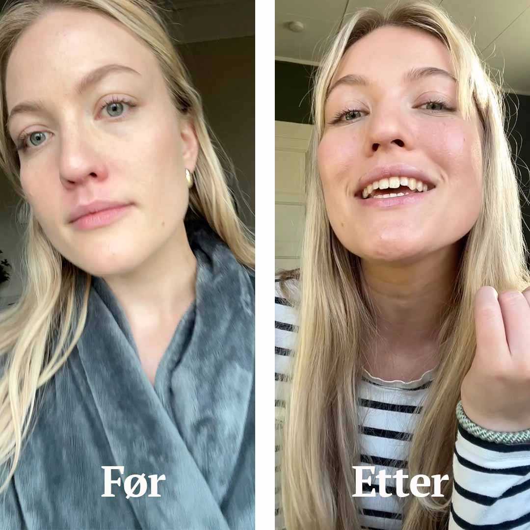 Utrolig Light Universalsalve for tørr, sår og irritert hud