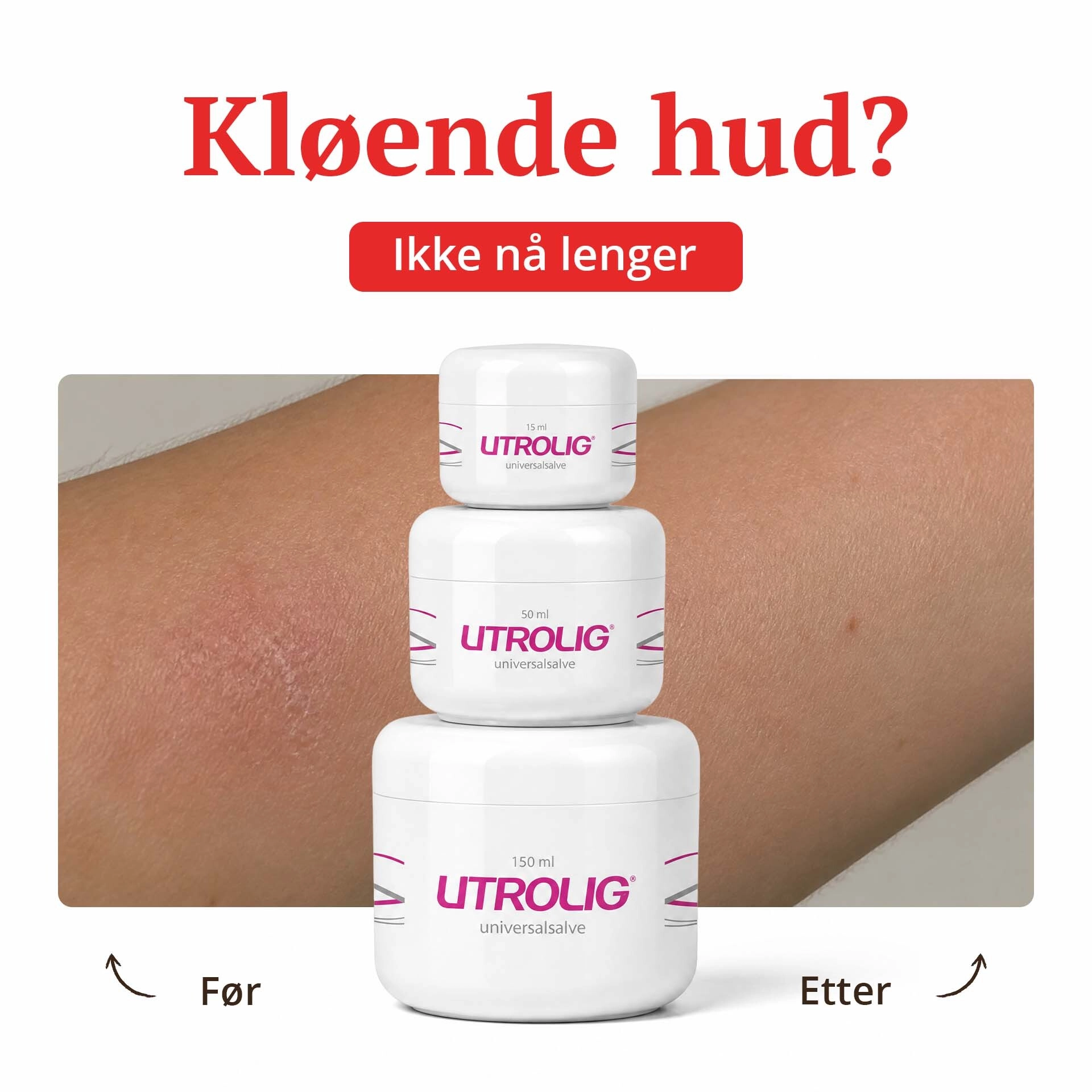 

Utrolig Universalsalve for tørr, sår, kløende og irritert hud.

