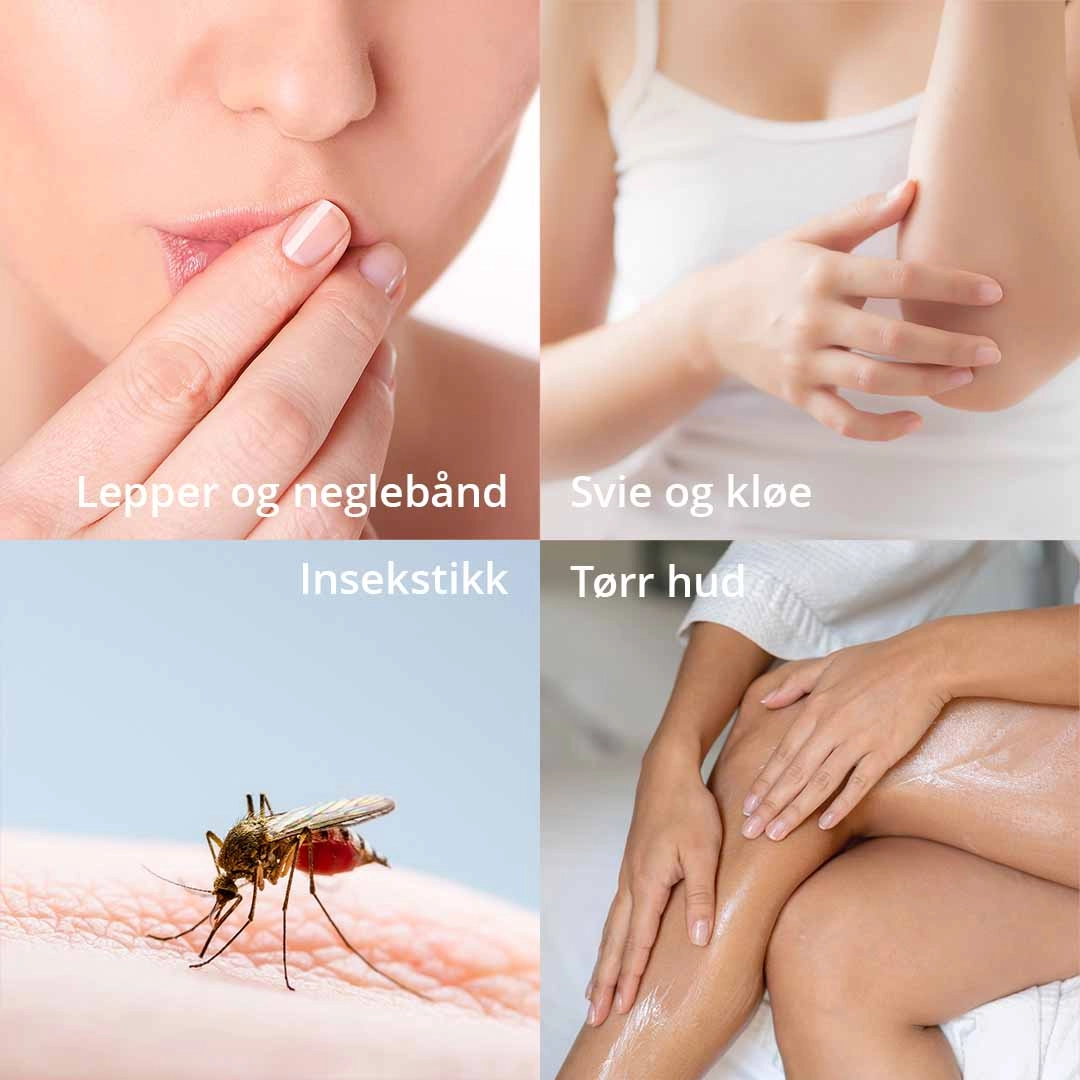 Utrolig Naturlig Universalsalve for tørr, sprukken og sår hud