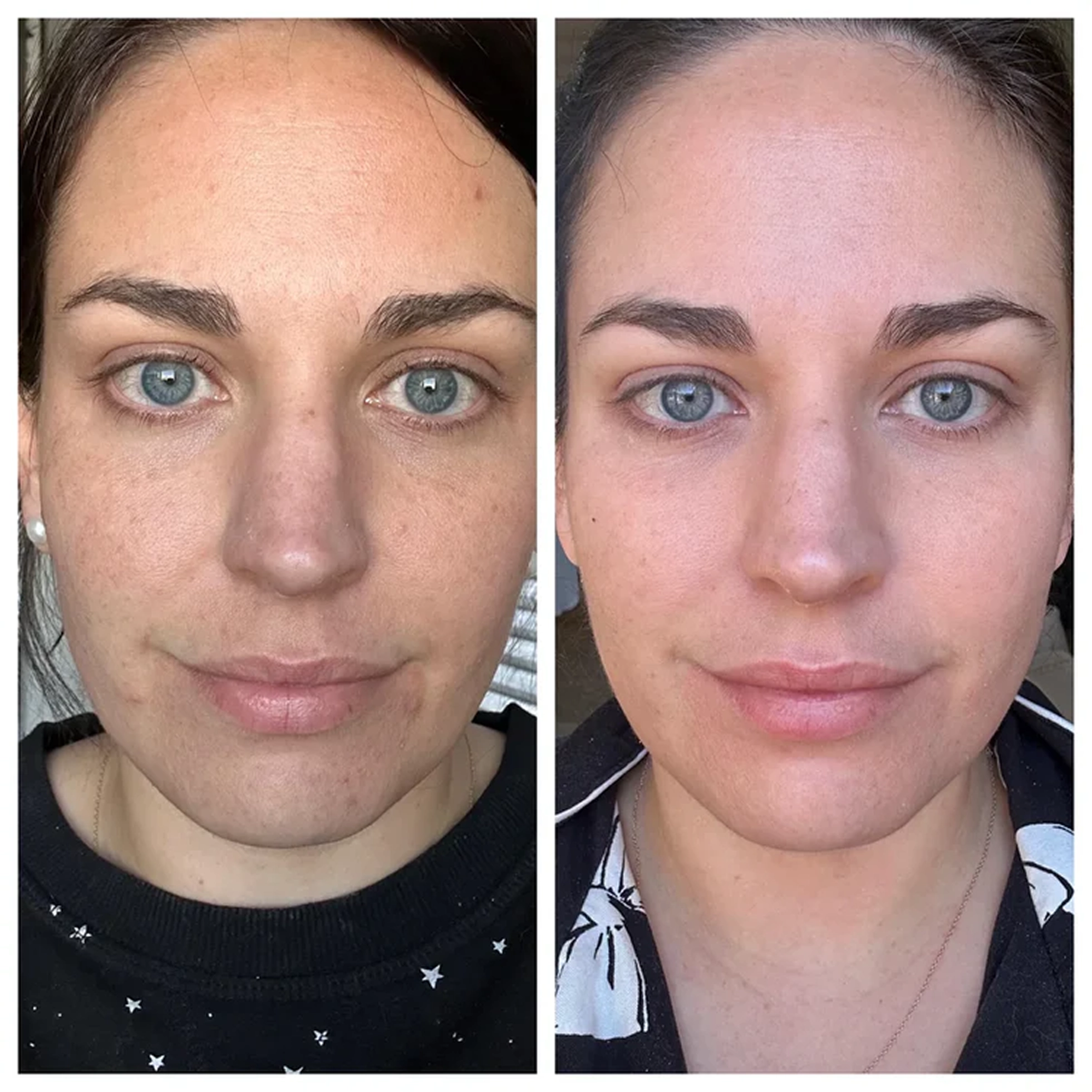 What Makes This Serum Different
