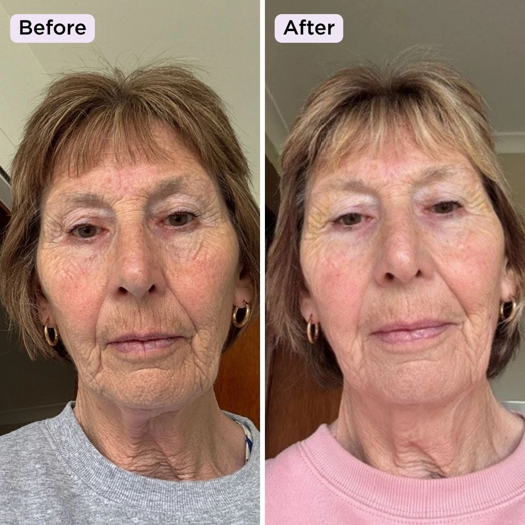 What is crepey skin? And why does it suddenly seem to appear in your 40s and 50s?