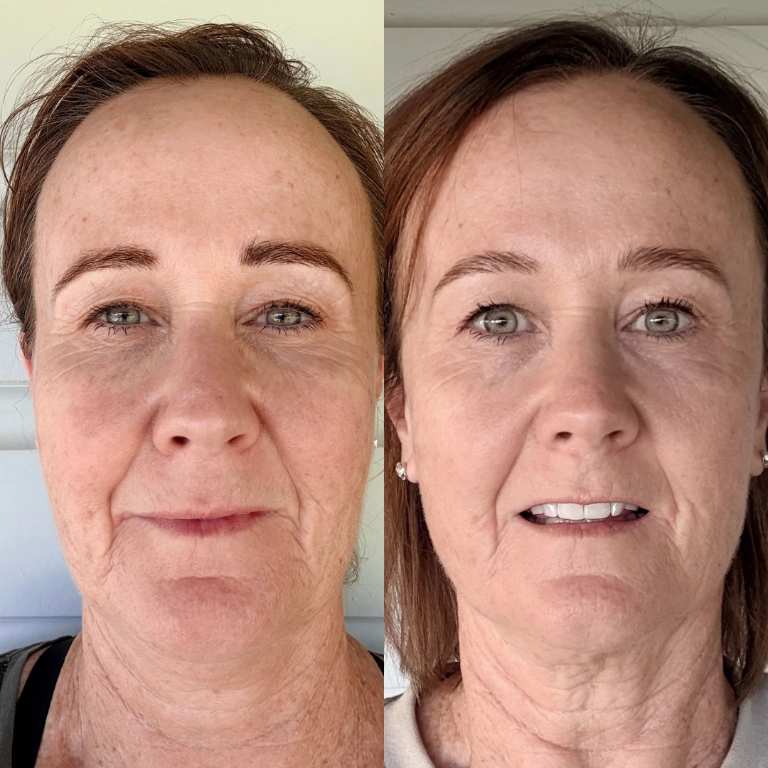 What is crepey skin? And why does it suddenly seem to appear in your 40s and 50s?