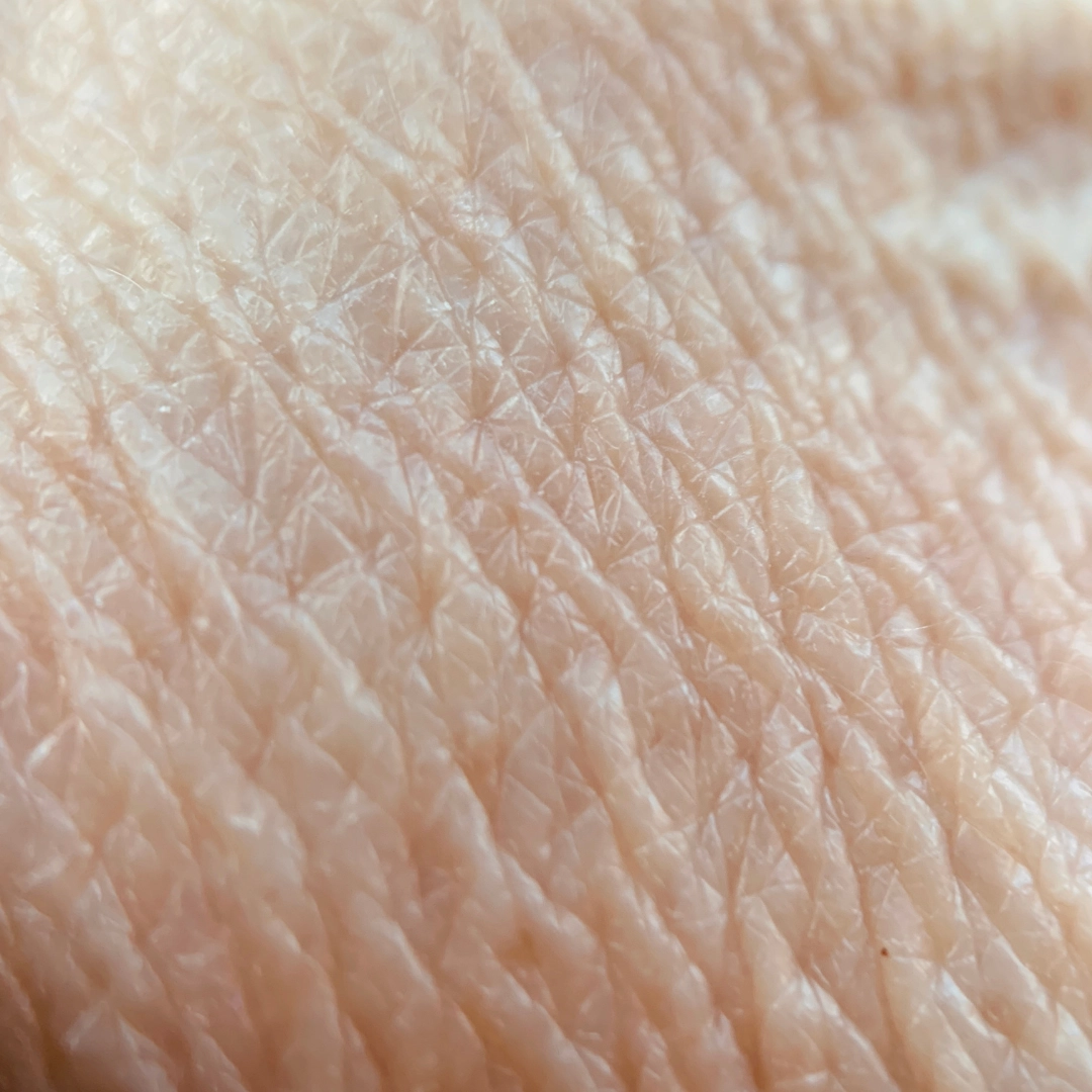 Crepey Skin
