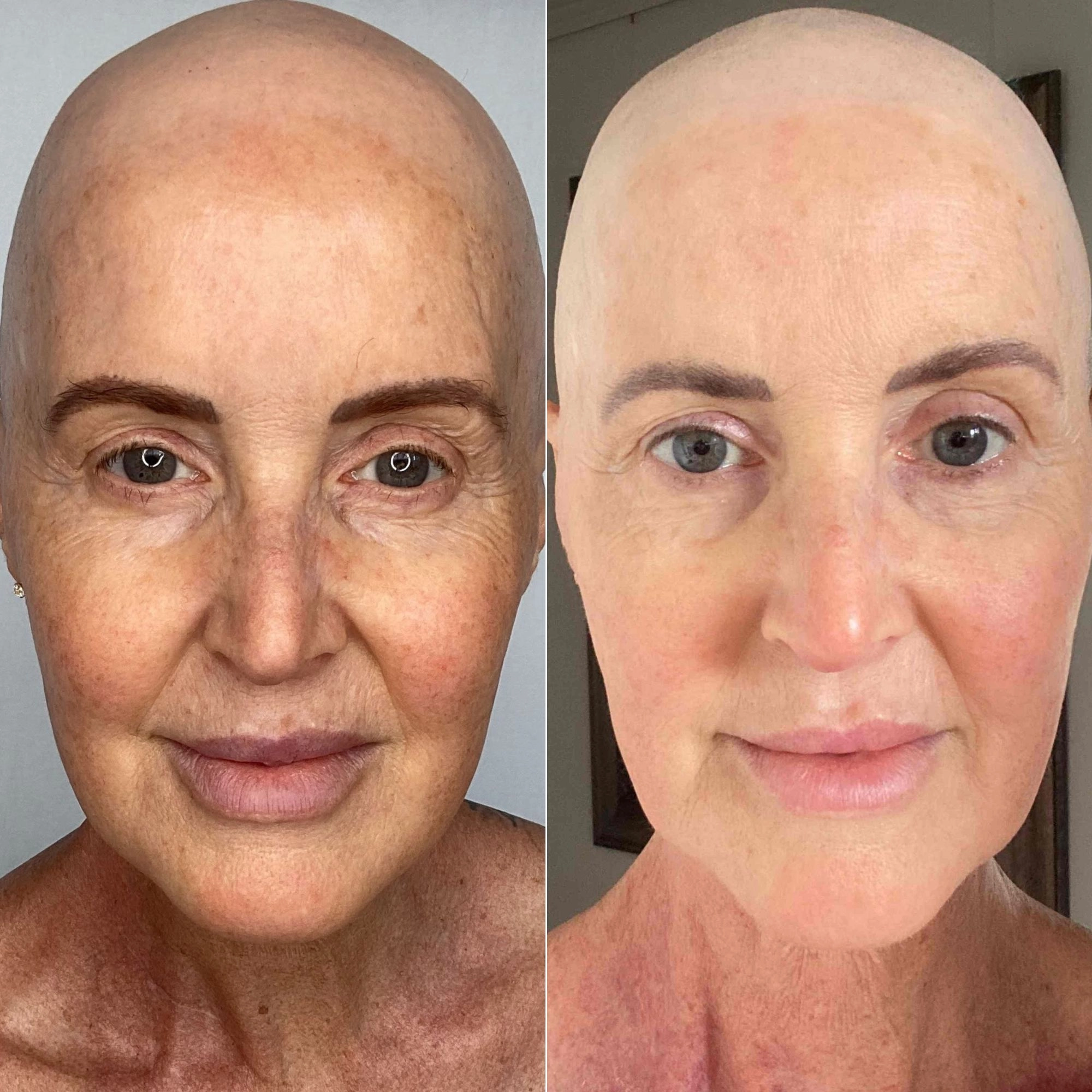 I Spent Thousands On Skincare That Did Nothing For My Pigmentation. Then I Found Two Products That Actually Changed My Skin.