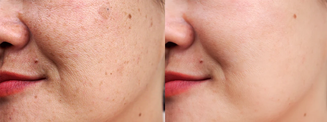 The Best Way to Start Your Skincare Journey