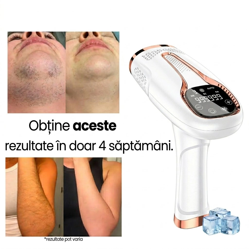 De ce mii de femei au ales Silky