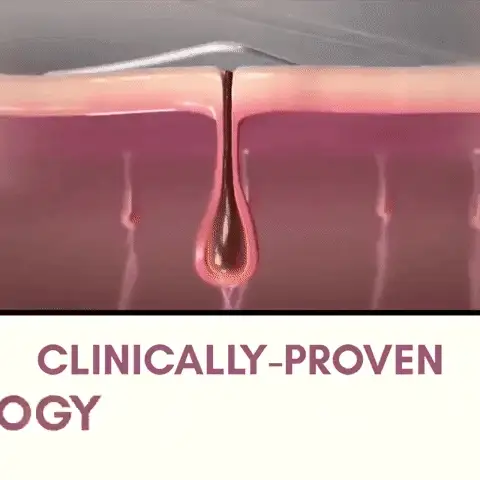 Uita Pentru Totdeauna de Parul Nedorit