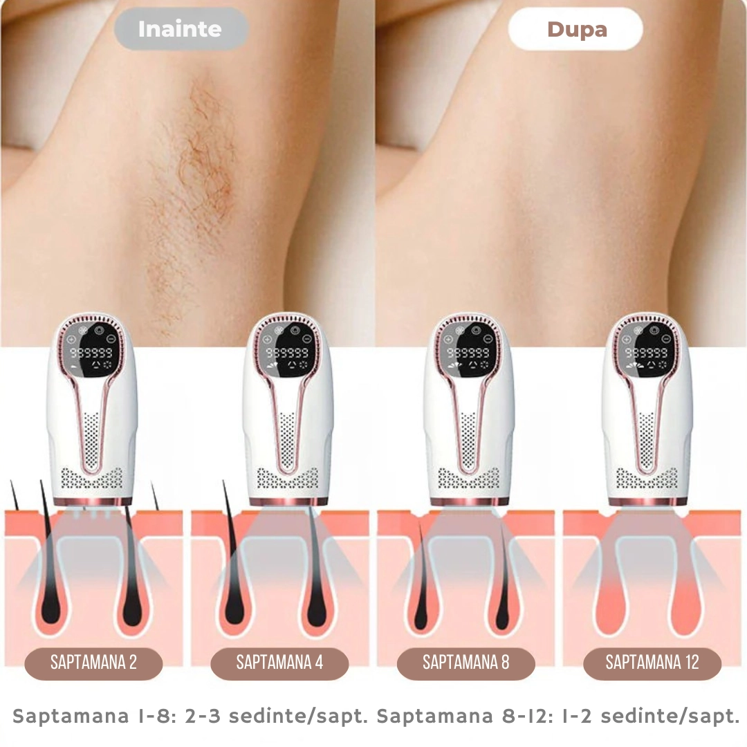 Silky rezolvă problema de la rădăcină