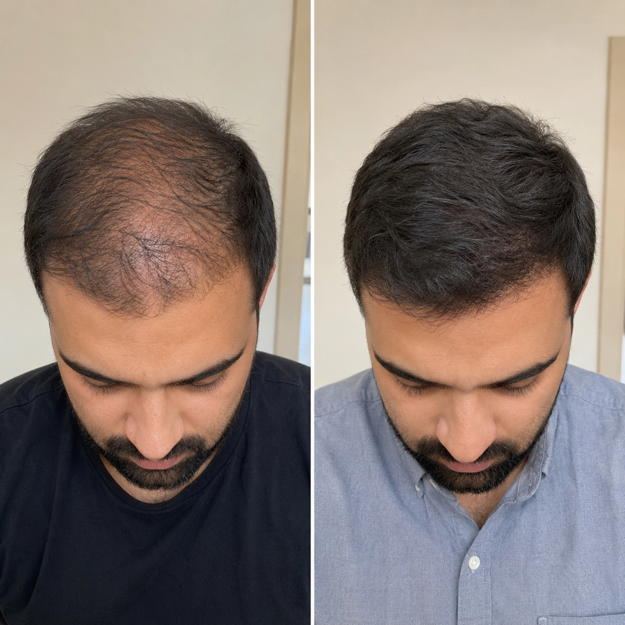 Reclaim Your Confidence and Protect Your Hair From Within