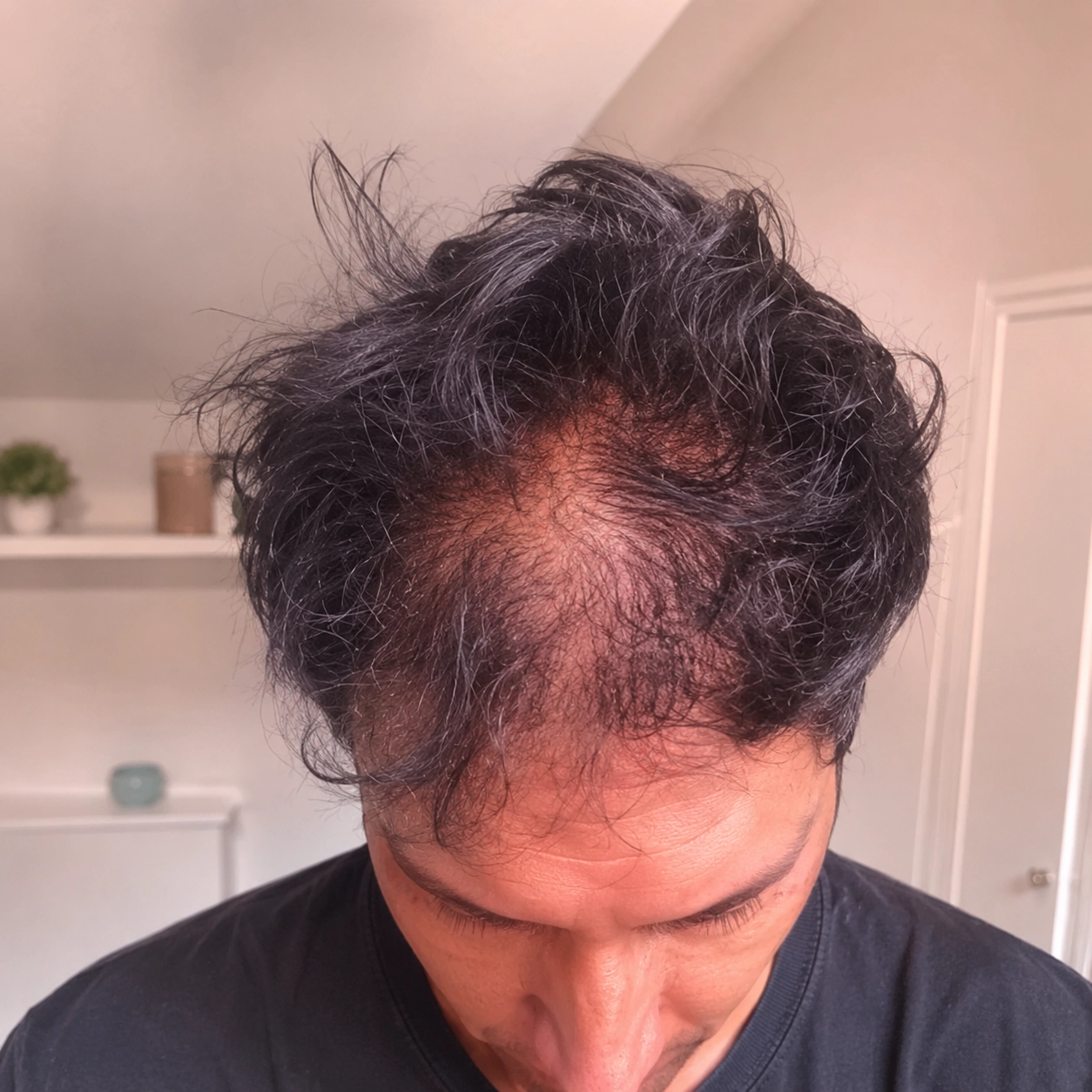 4. No dread shed