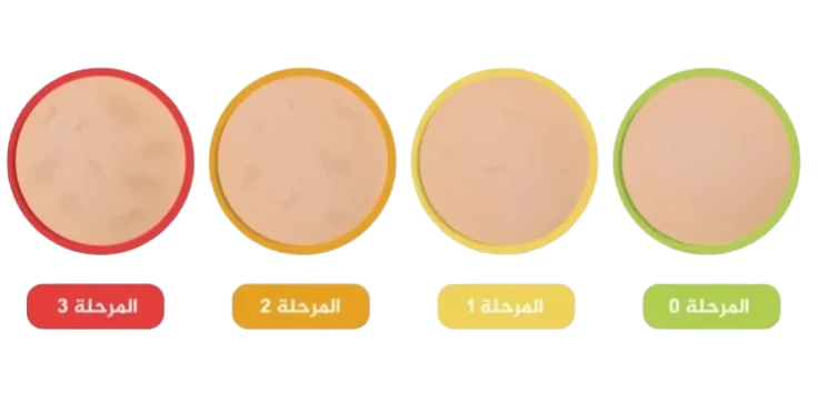 الرجيم بعد الولادة ينحّف... بس ما 