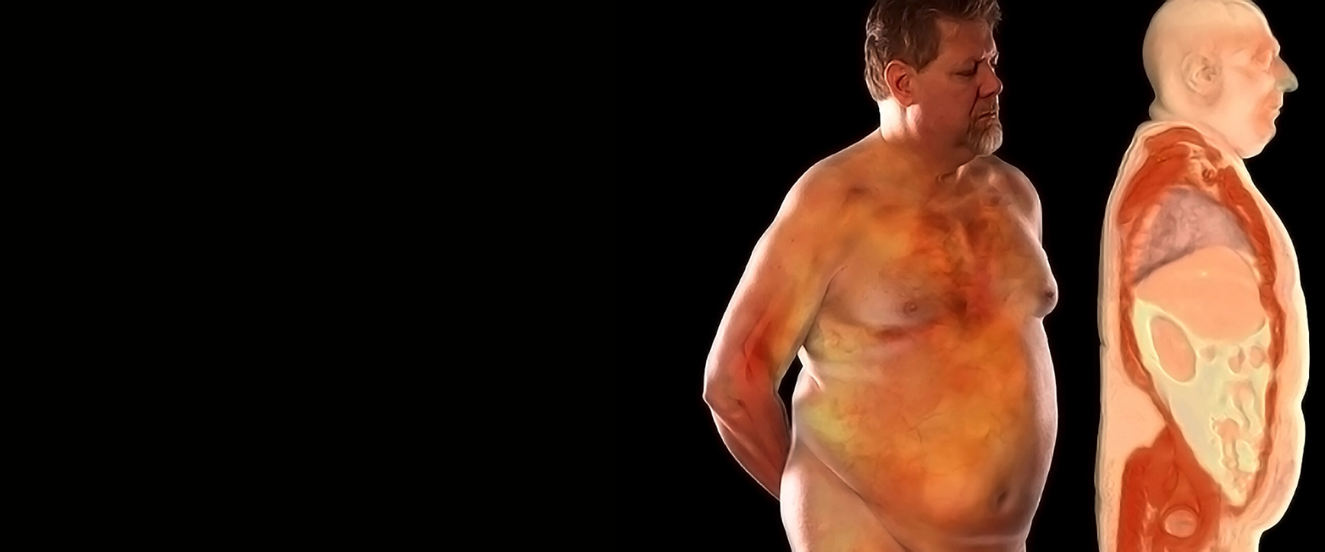 5 reasons why managing your blood sugar isn't enough to save your sex life
