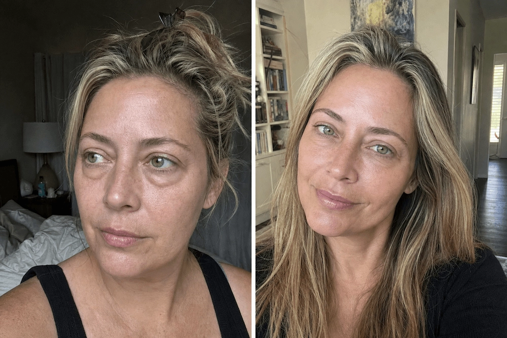 Thousands of women amazed how these natural 'drain'-drops wipe the 'tired, puffy layer' of their faces.