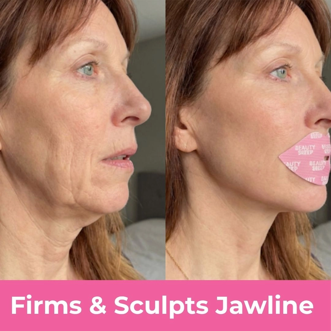 2. It Prevents Jawline Sag & Neck Wrinkles