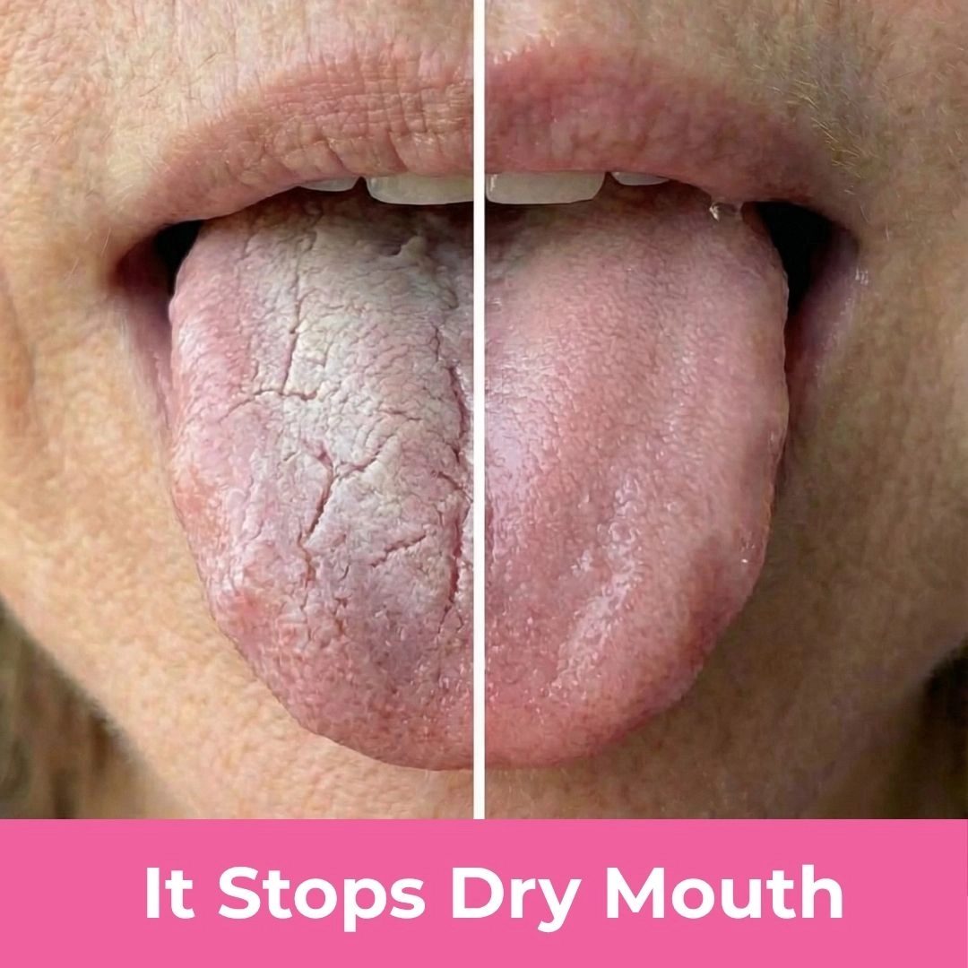 4. It'll improve your teeth and gum health and prevent bacterial build up from dry mouth