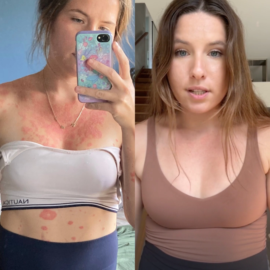 Skin takes 20-35 days to renew